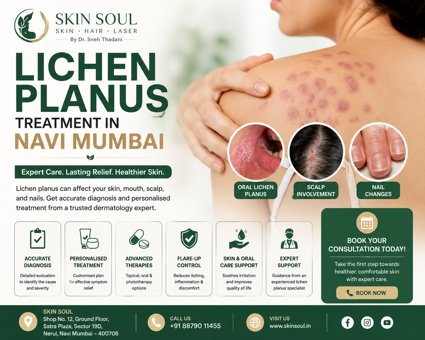 Lichen Planus Treatment in Navi Mumbai 